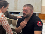 “Mbi 50 të plagosur”, Ministria e Shëndetësisë: 23 policë dhe 5 protestues të lënduar gjatë orës së fundit